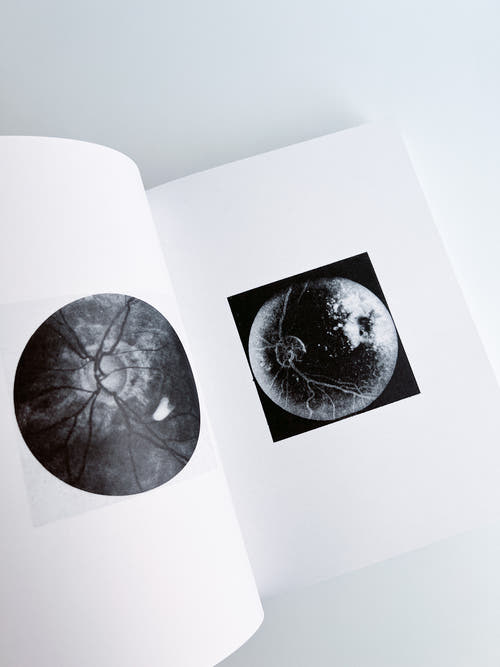3000 Days of Archives Related to the Optics and Glasses Frame Industry